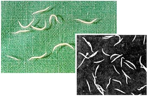 Pinworms aus dem mënschleche Kierper