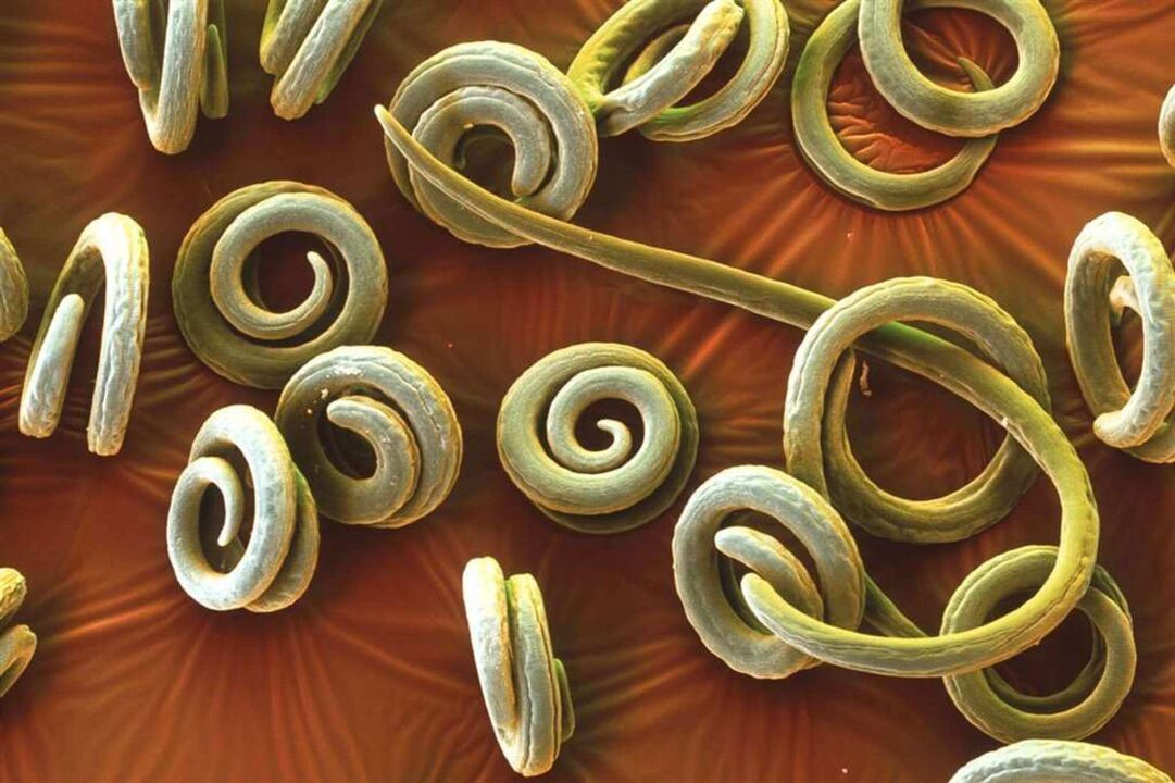 Würmer Parasiten aus dem mënschleche Kierper