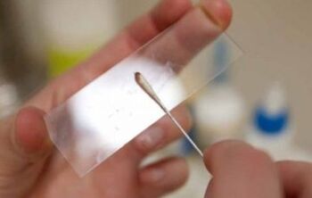 Wat Tester solle fir Parasiten geholl ginn