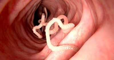 D'Ursaachen vun de Parasiten am mënschleche Kierper