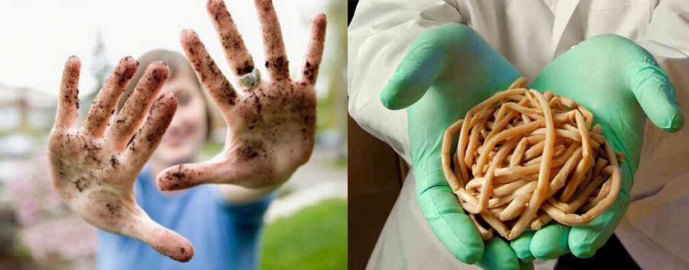 Parasiten kënnen duerch dreckeg Hänn an de Kierper kommen
