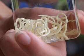 Parasiten aus dem mënschleche Kierper