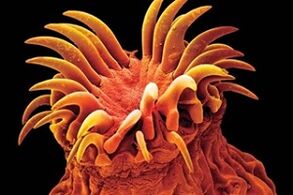 Trematoden Parasiten bei Mënschen