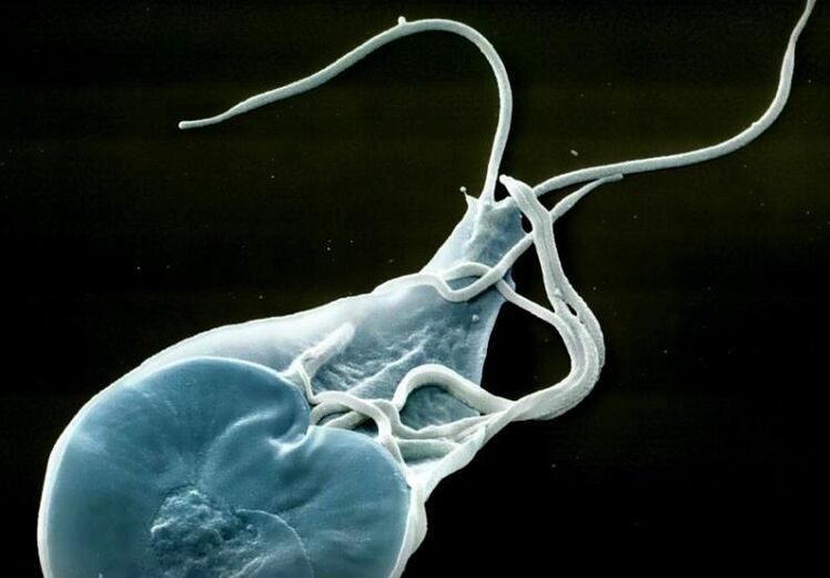 intestinal Lamblia bei Mënschen